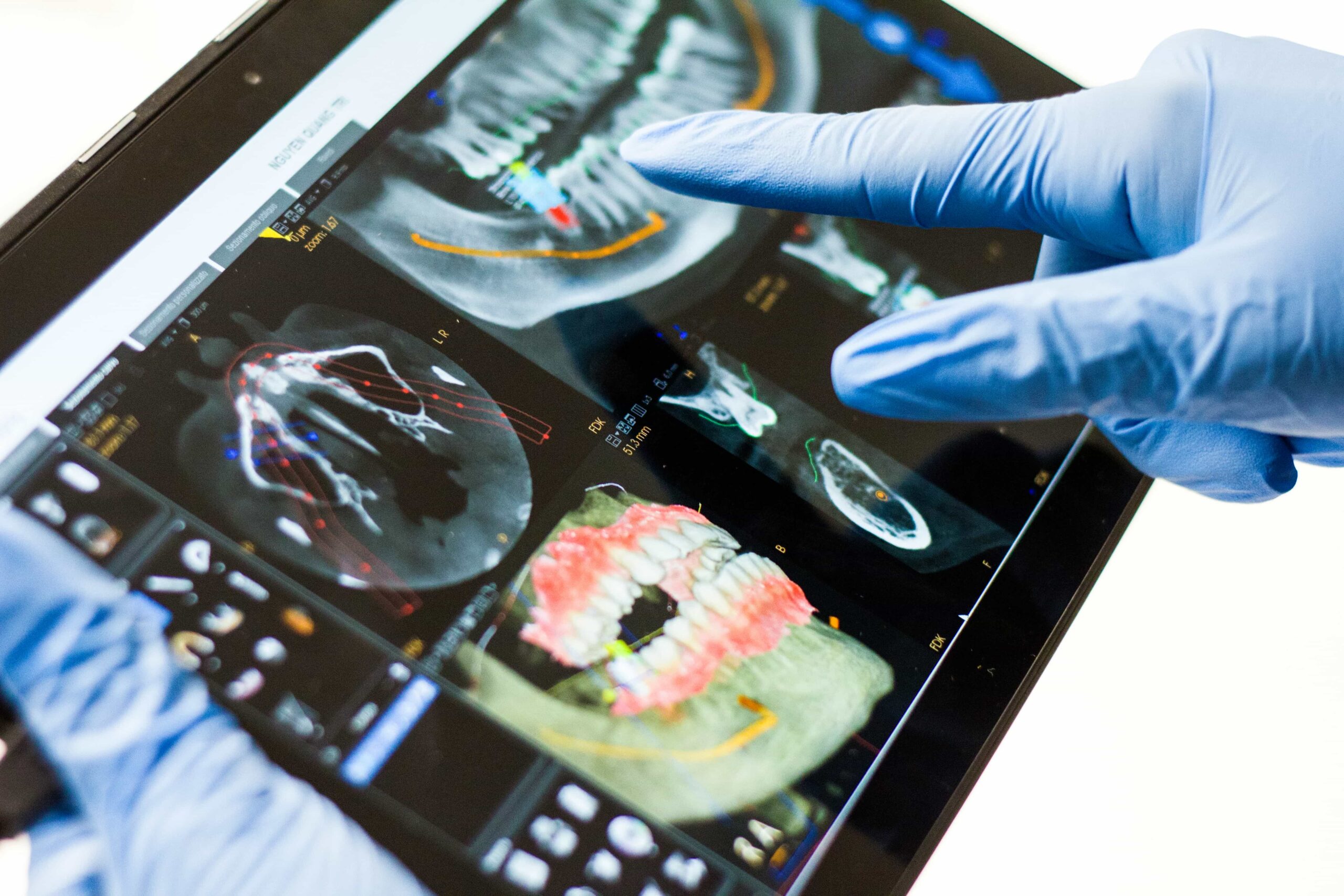 Stop the Bleeding: How to Get Rid of Gum Disease Fast 4 xray scan of inside mouth and teeth