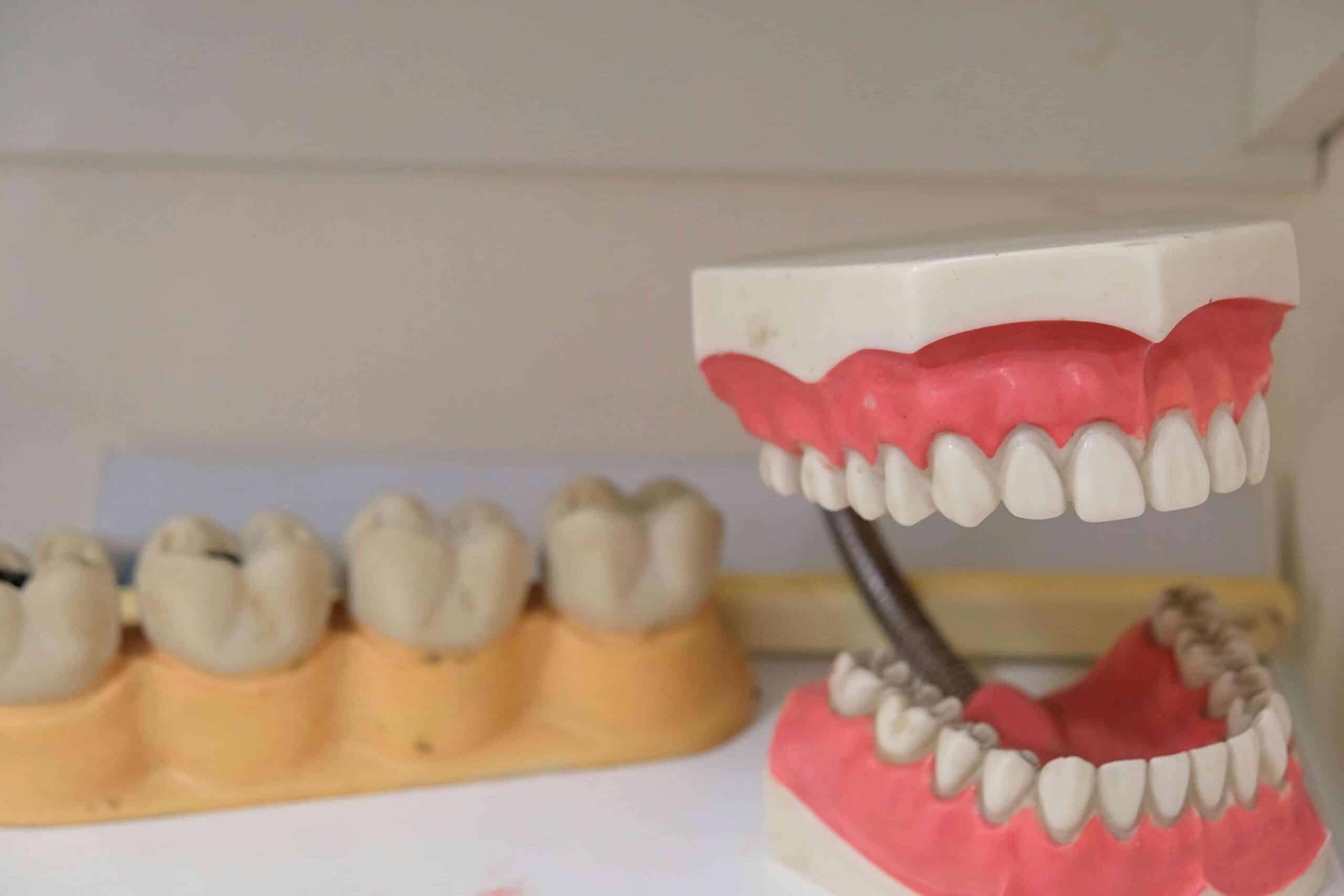 The Science of Tooth Enamel: How Nature's Hardest Substance Protects Your Child’s Smile 4 model teeth inside dental clinic