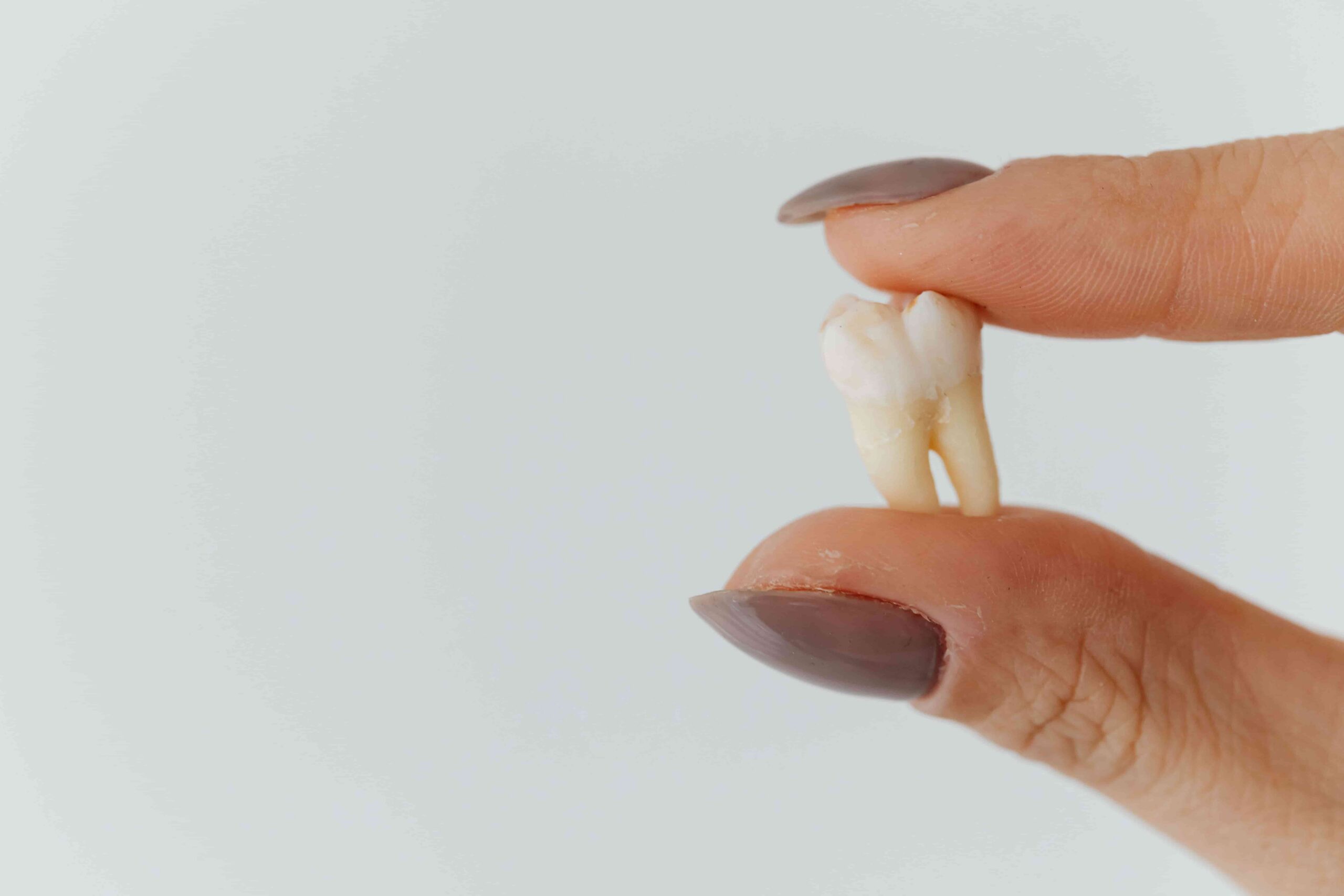 DIY Dental Cement Fix at Home: Advice from a Dentist 4 hand holding tooth